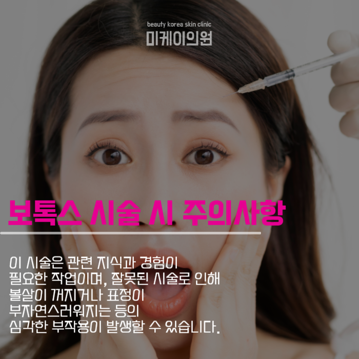 사각턱보톡스 활용하여 아름다운 얼굴을 관련 이미지 3