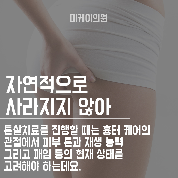 튼살관리방법 초기에 적극적으로 관련 이미지 2