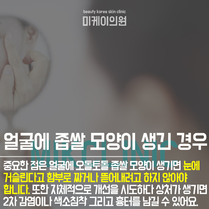 한관종생기는이유 개인마다 다를 수 있어 관련 이미지 4