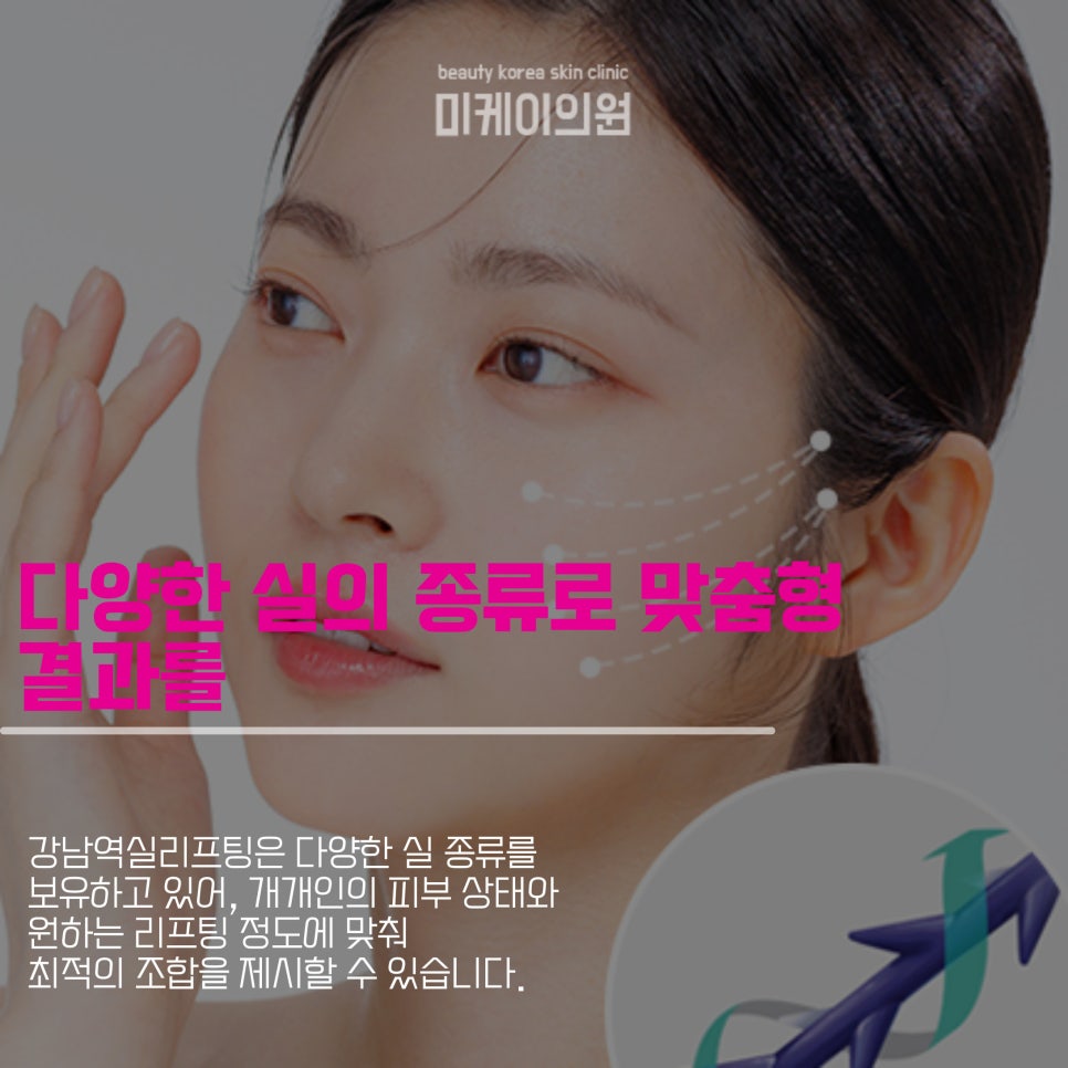Regaining Youth with Thread Lifting at Gangnam Station image 4