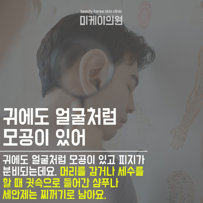 귓속 뾰루지 방치하지 마세요 관련 이미지 3