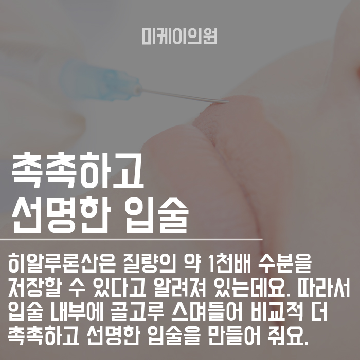 서초동입술필러로 사랑스러운 입모양 관련 이미지 2