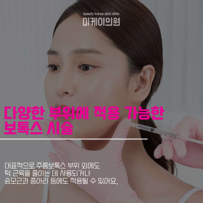 주름보톡스 부위는 어디일까 관련 이미지 3
