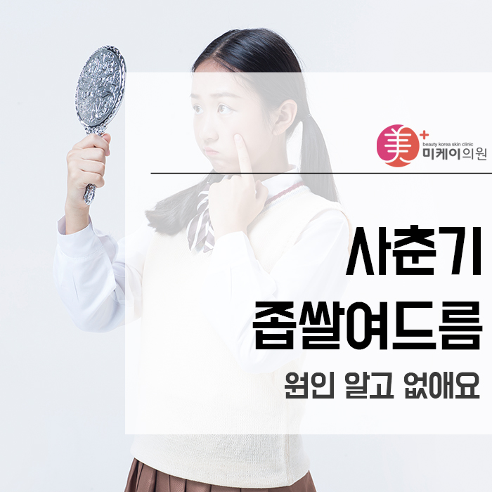 사춘기좁쌀여드름 원인 알고 없애요 관련 이미지 1