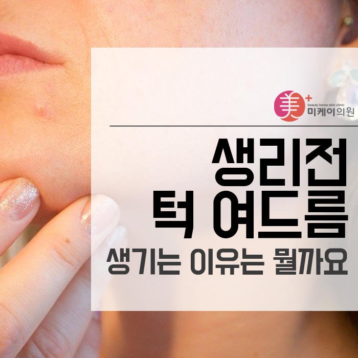 생리전 턱여드름 생기는 이유는 뭘까요 관련 이미지 1