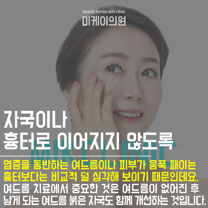 여드름관리하는방법 개인마다 다를 수 있어 관련 이미지 5