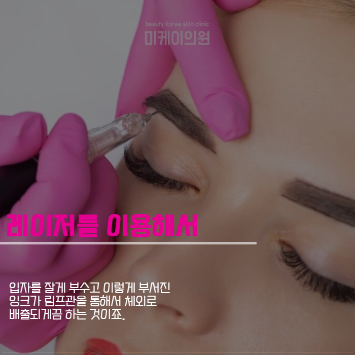눈썹문신 잔흔없애는법 너무 신경 쓰인다면 관련 이미지 5