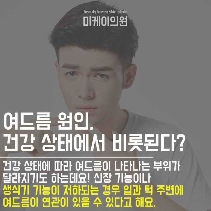 남자여드름관리 상태에 따라 다르게 관련 이미지 3
