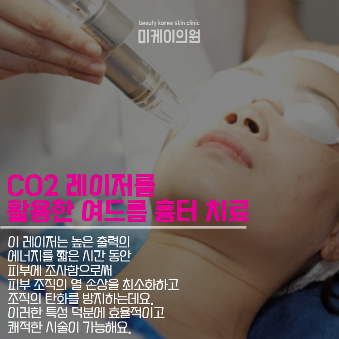여드름흉터치료피부과 맞춤형 치료 서비스 관련 이미지 3