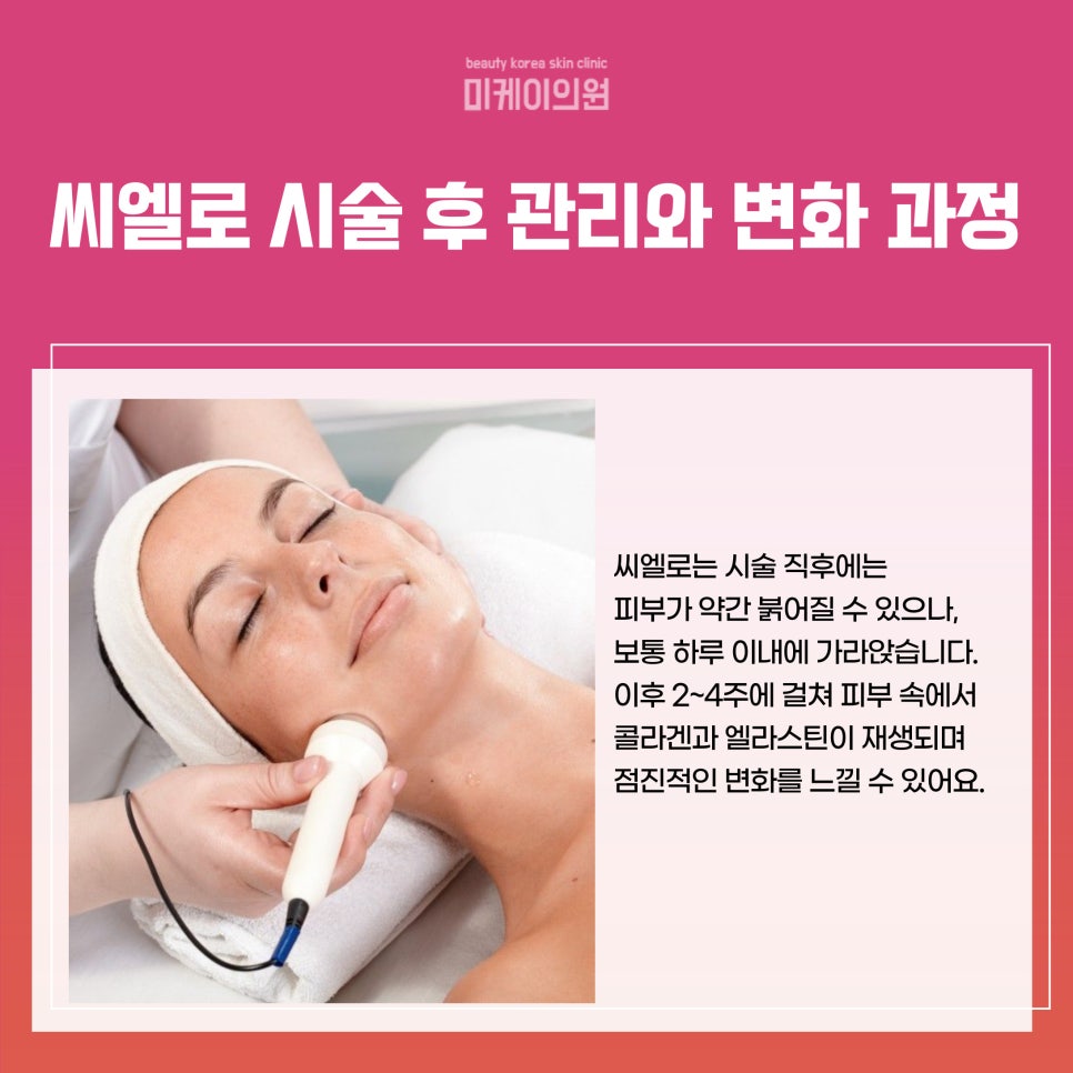 강남 피부과의원 씨엘로 시술의 모든 것 관련 이미지 4