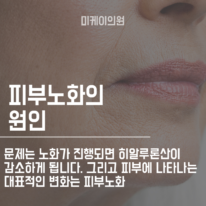 피부물광주사 건성피부염 해결 할 수 있을까 관련 이미지 3