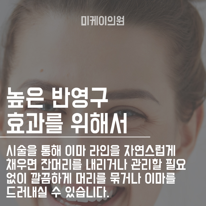 숱이 적은 헤어라인 반영구 자연스럽게 채워요 관련 이미지 4