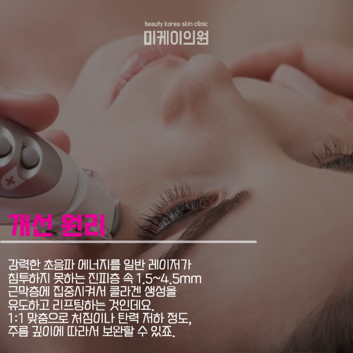 눈가주름시술 아이슈링크로 해결하세요 관련 이미지 3