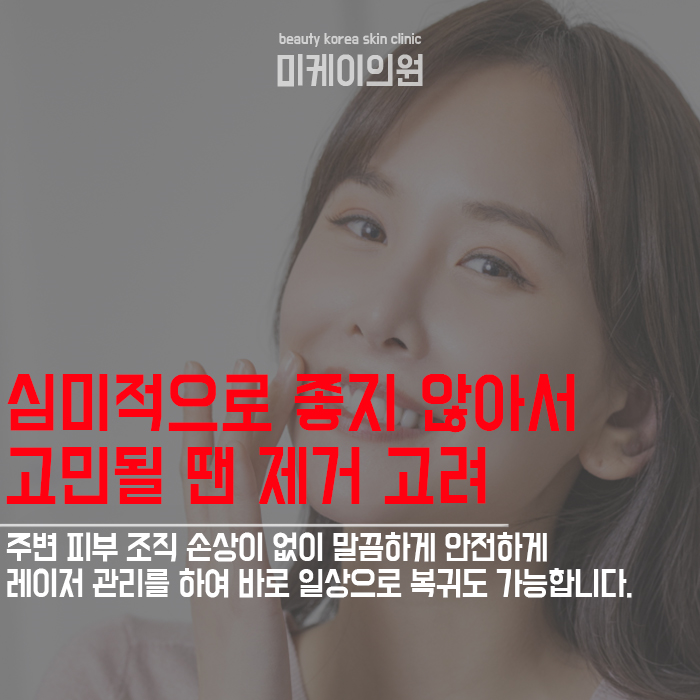 검버섯발생원인 생활 속 예방법 알아봐요! 관련 이미지 4