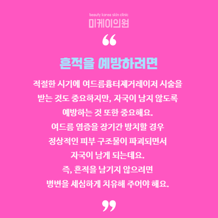 여드름흉터제거레이저 짧은 시간에 간단하게 관련 이미지 6