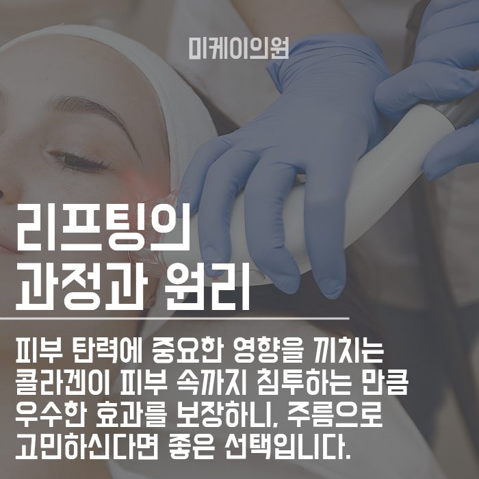 캐번실리프팅 팔자주름 당기고 채우자 관련 이미지 2