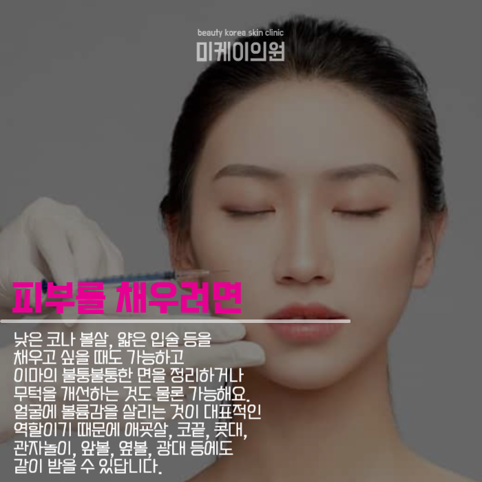 필러와보톡스차이 알아야 받을 수 있죠 관련 이미지 3