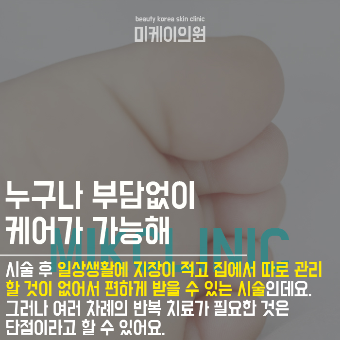발바닥 티눈 원인 초기에 관리를 시작해요 관련 이미지 3