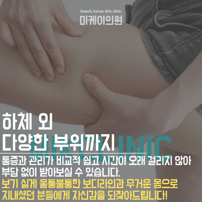 다리지방분해주사 숨겨진 라인 찾기! 관련 이미지 4