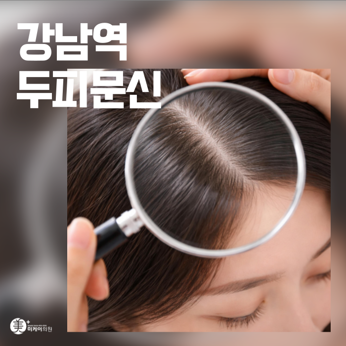 강남역 두피문신 자연스러운 빽빽한 헤어라인 관련 이미지 1