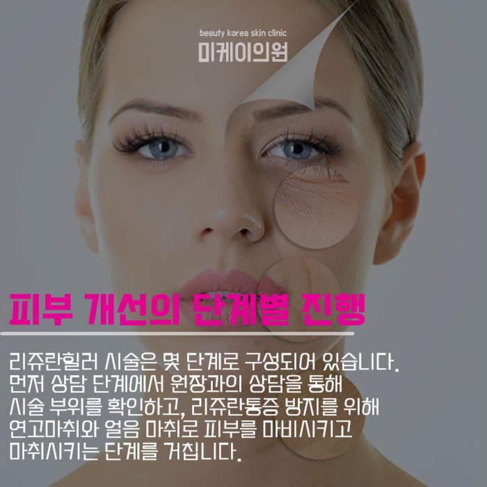 리쥬란통증 두려워할 필요 없어 관련 이미지 3