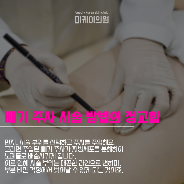 강남역 지방분해주사 여름을 위한 몸매 관리 관련 이미지 4