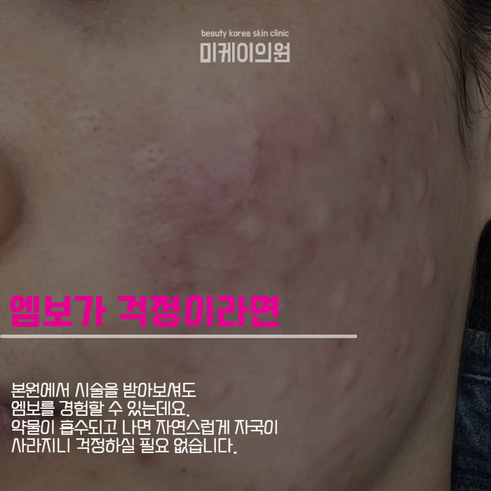 Excellent for Fine-Wrinkle Care at Gangnam Station Skin Botox image 3