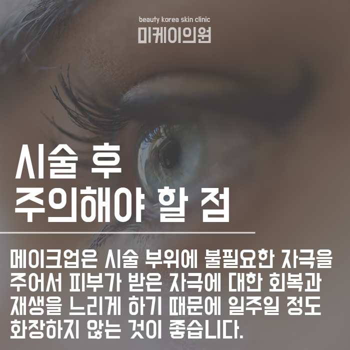 반영구아이라인 생얼로 당당하게 외출해요! 관련 이미지 4