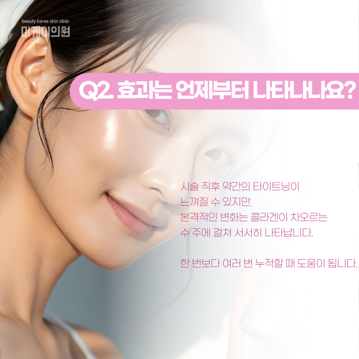 강남 인모드, FX와 포마는 뭐가 다를까? 관련 이미지 3