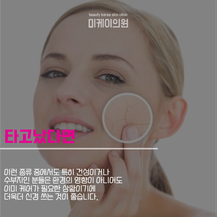 속건조 개선 방법 본격적으로 케어하세요 관련 이미지 2