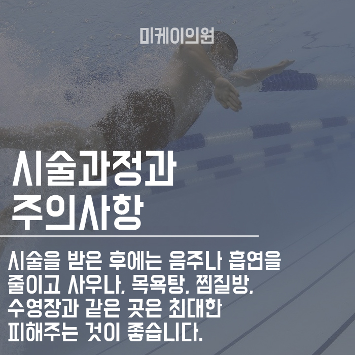검버섯레이저 알아보고 있다면 이곳에서! 관련 이미지 4