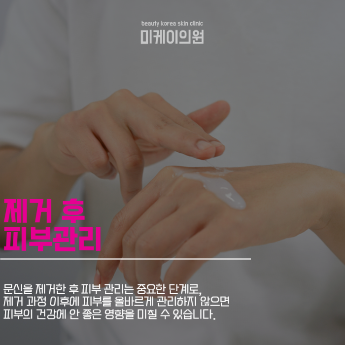 문신제거기간 및 주의사항 살펴보기 관련 이미지 5