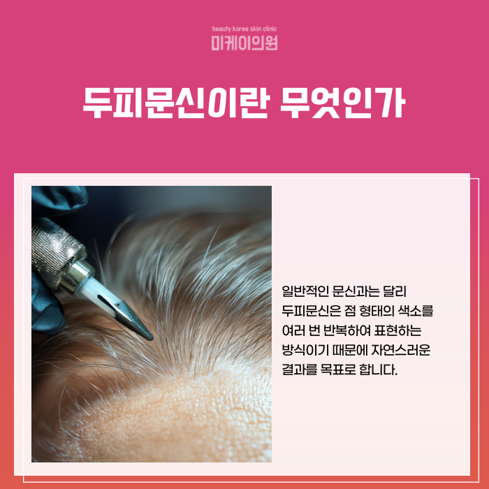 서초 두피문신 잘하는곳 티 안나게 관련 이미지 2