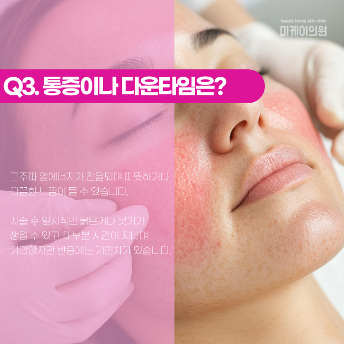 강남 인모드, FX와 포마는 뭐가 다를까? 관련 이미지 4