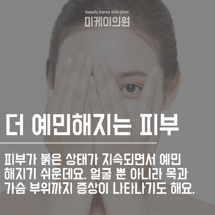 홍조가 나타나는 이유와 관리방법 관련 이미지 2