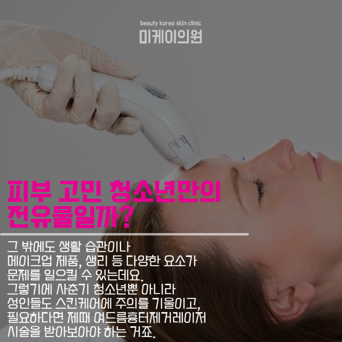 여드름흉터제거레이저 짧은 시간에 간단하게 관련 이미지 2
