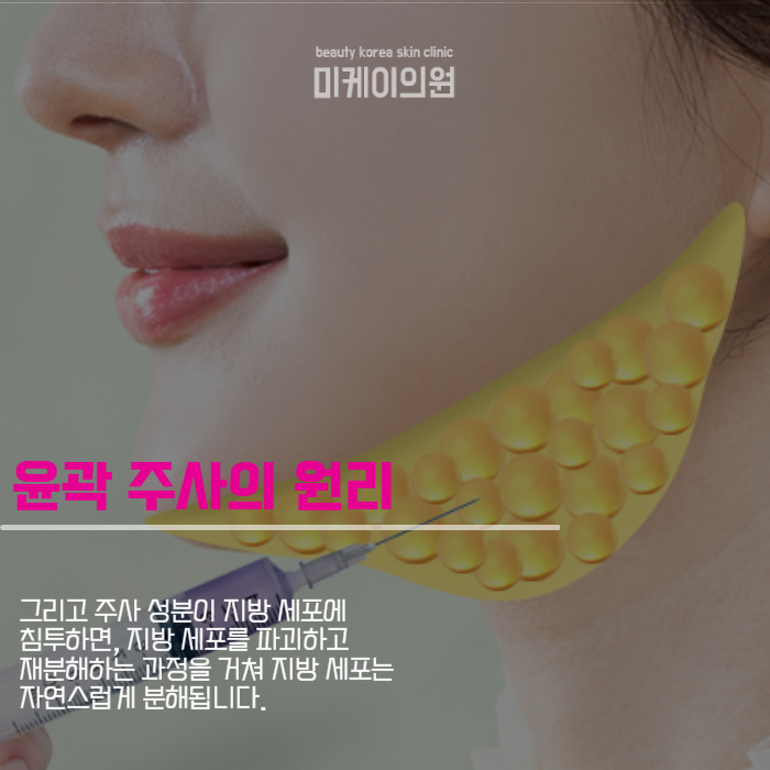 강남역 윤곽주사 자연스럽게 잘 하는 곳 관련 이미지 4