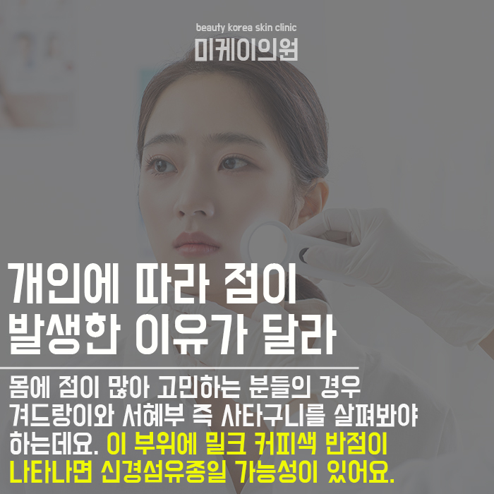 몸에점이많아요 관심이 필요한 이유 관련 이미지 2