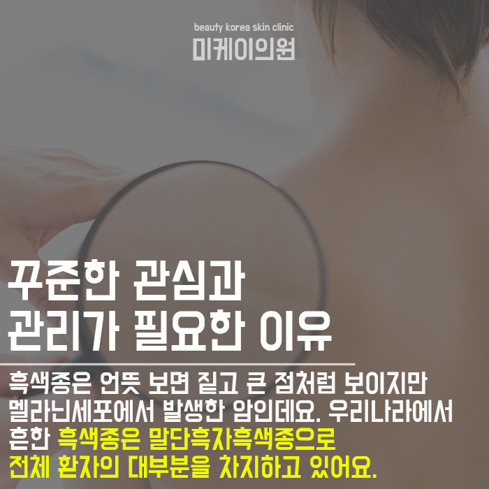 몸에점이많아요 관심이 필요한 이유 관련 이미지 3