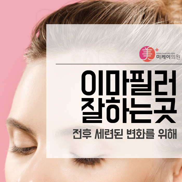 이마필러잘하는곳 전후 세련된 변화를 위해 관련 이미지 1