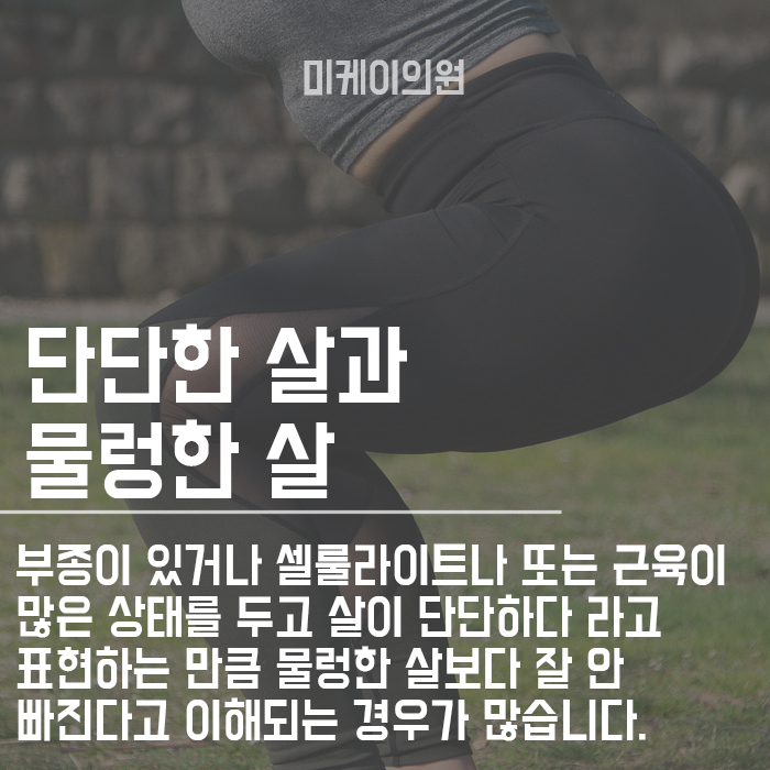 처진뱃살 없애는 쉬운 방법! 관련 이미지 4