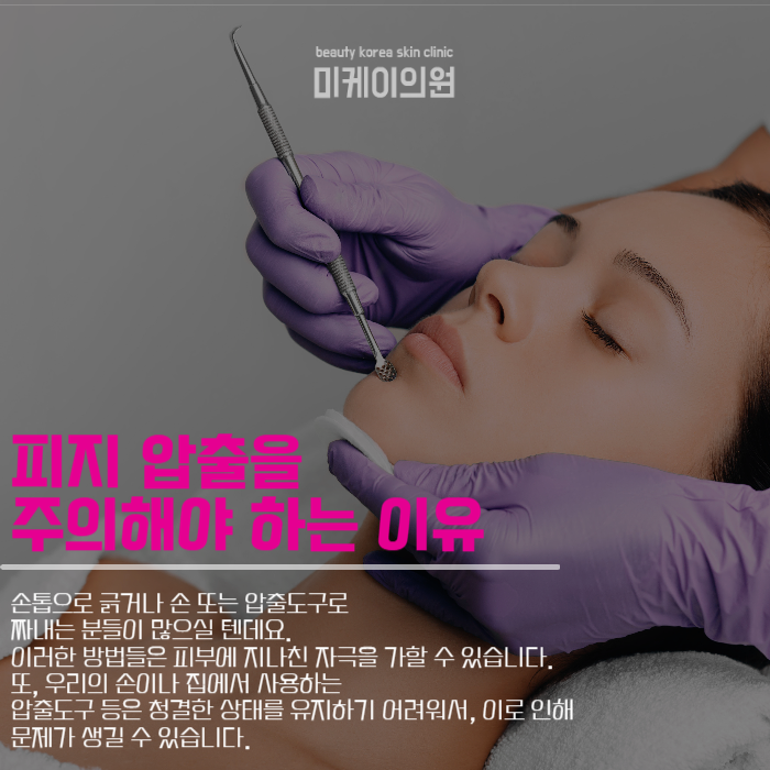 블랙헤드제거방법 자극을 줄이려면 관련 이미지 3