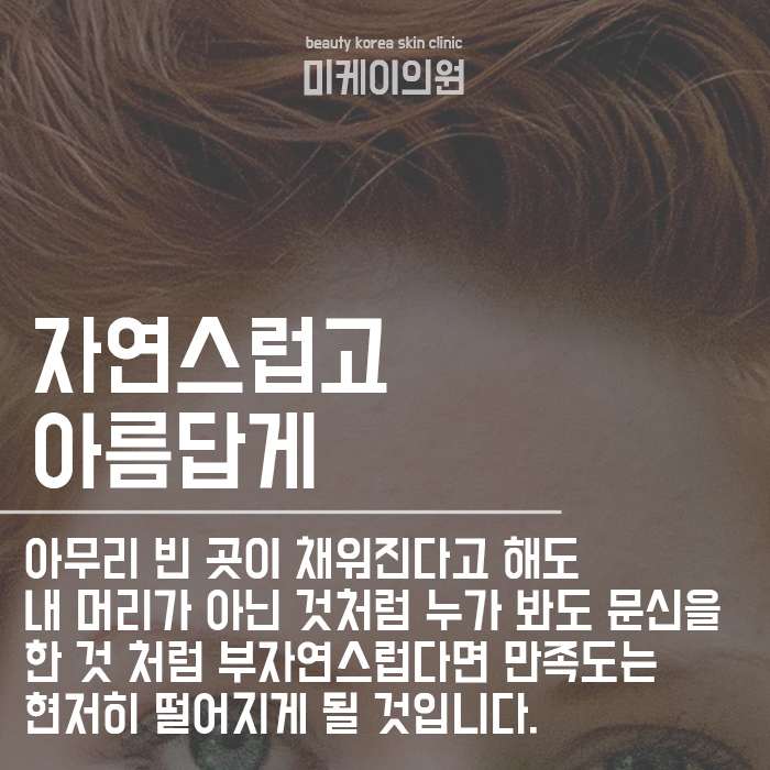 서초동헤어라인반영구 이제는 신경 써야 할 때 관련 이미지 4