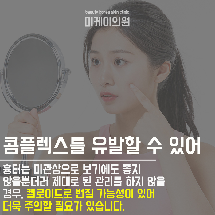 켈로이드흉터관리방법 어렵지 않아요 관련 이미지 3