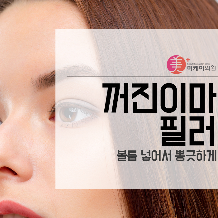꺼진이마 필러로 볼륨 넣어서 뽕긋하게 관련 이미지 1