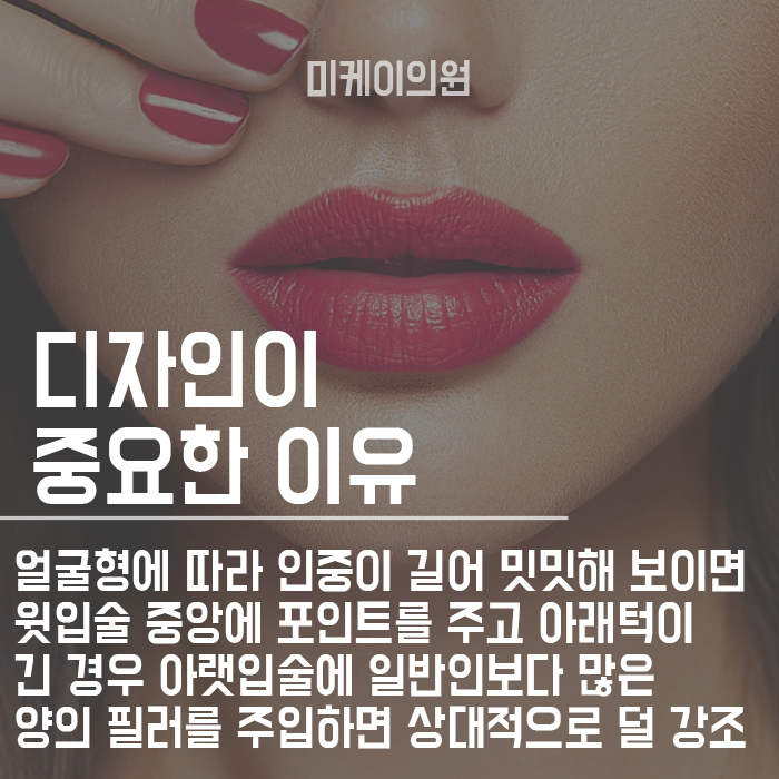 입술필러잘하는곳 마무리까지 확실하게 관련 이미지 2