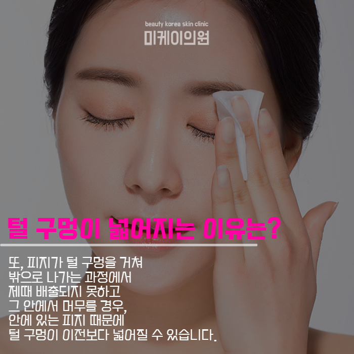 모공축소시술가격 아쿠아필로 매끄럽게 관련 이미지 4