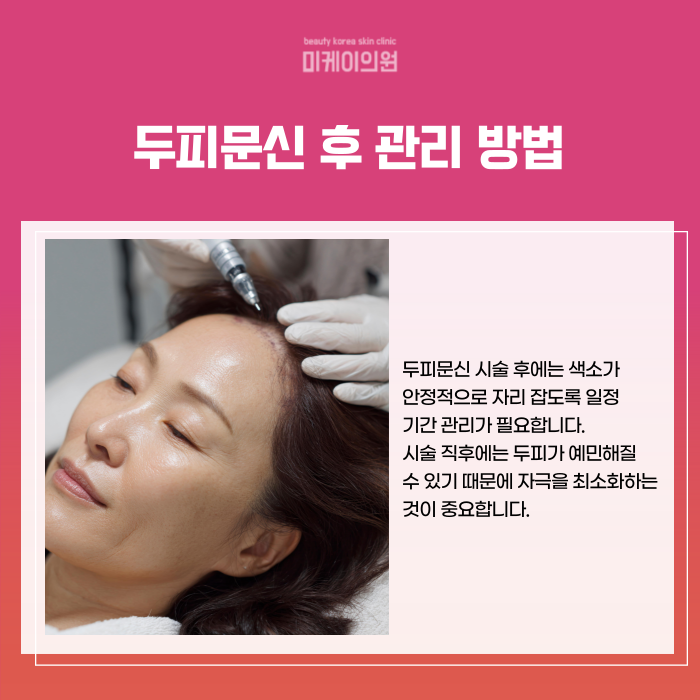 Gangnam Station Scalp Micropigmentation: How to Naturally Cover Thinning Hair image 5