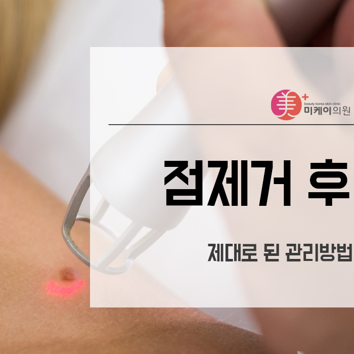 점제거 후 제대로 된 관리방법 관련 이미지 1