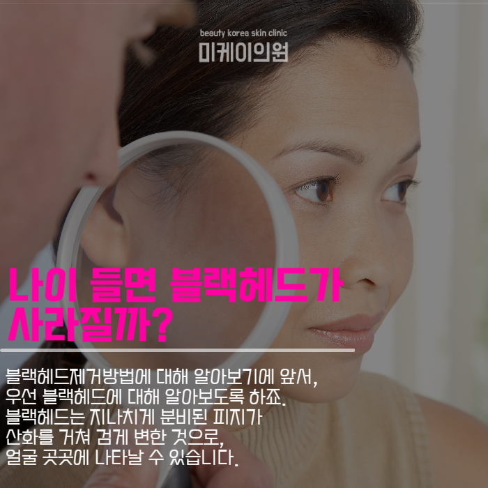 블랙헤드제거방법 자극을 줄이려면 관련 이미지 2